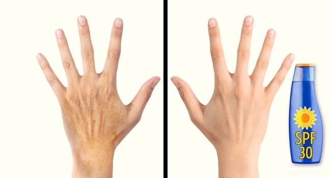 5 საიდუმლო, რომელიც თქვენს ხელებს ახალგაზრდულ იერს შეუნარჩუნებს და კანის დაბერების პროცესს შეაფერხებს