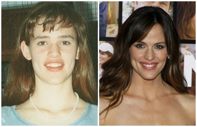 როგორ გამოიყურებოდნენ ცნობილი ადამიანები თინეიჯერობის პერიოდში - 16 დაუჯერებელი ფოტო