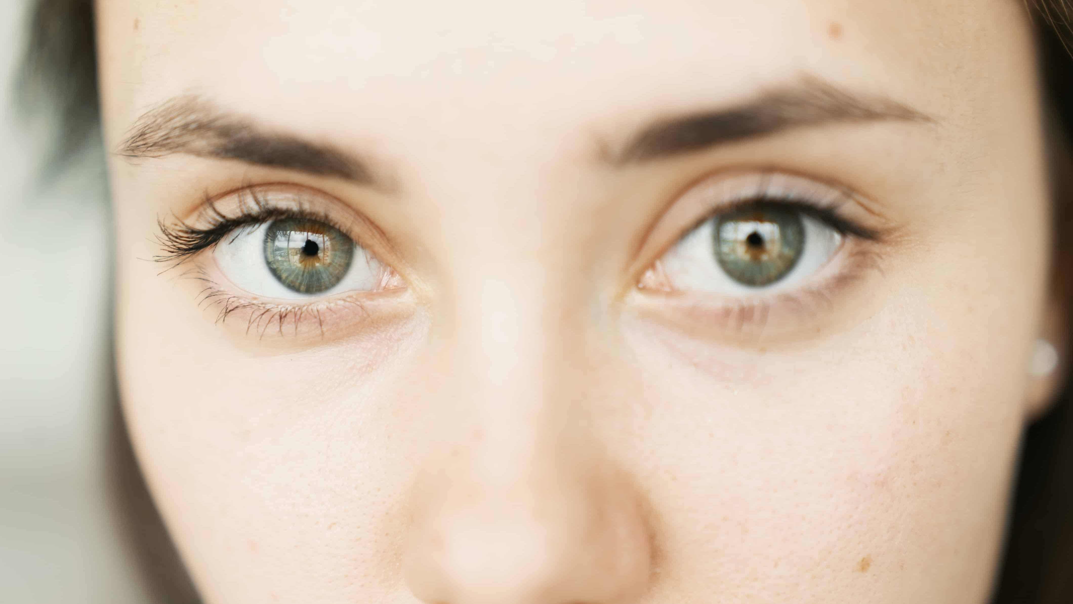 რატომ გვიჩნდება მუქი წრეები თვალის ქვეშ და როგორ დავამარცხოთ პრობლემა